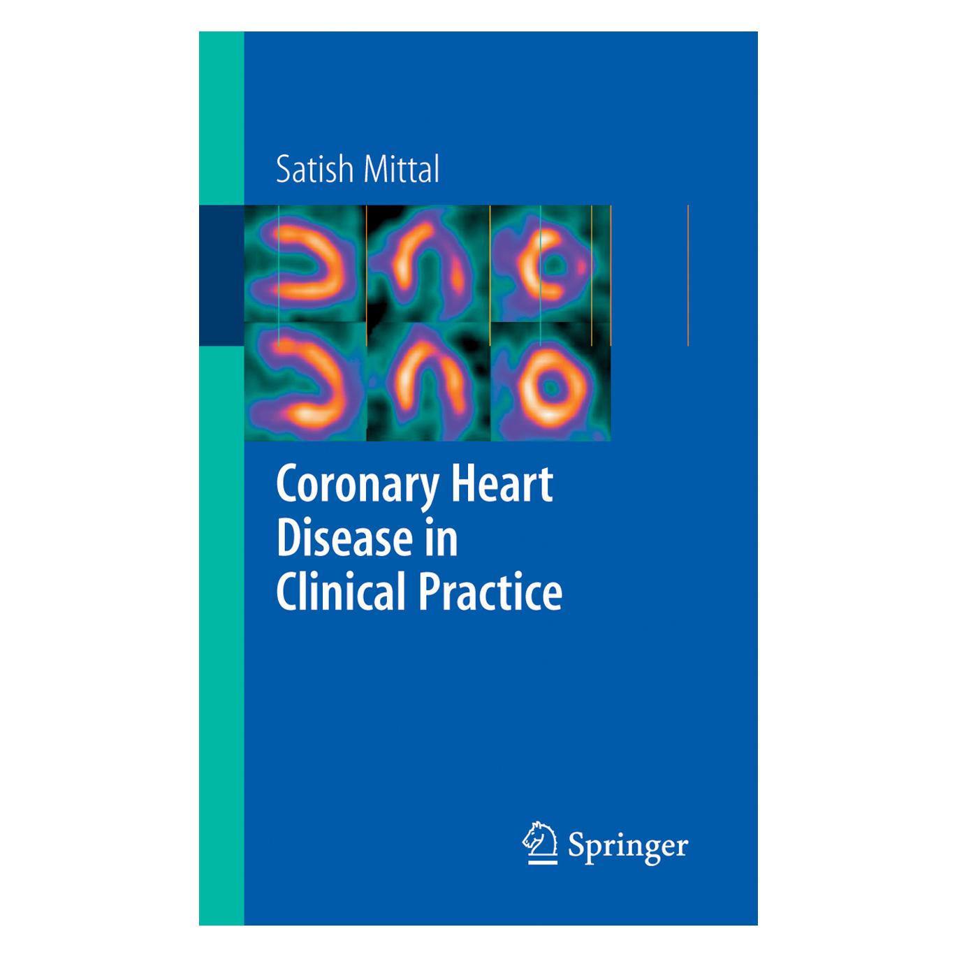 Springer Mittal,S.:Coronary Heart Disease (Englisch, Softcover, Satish Mittal) (63402784)