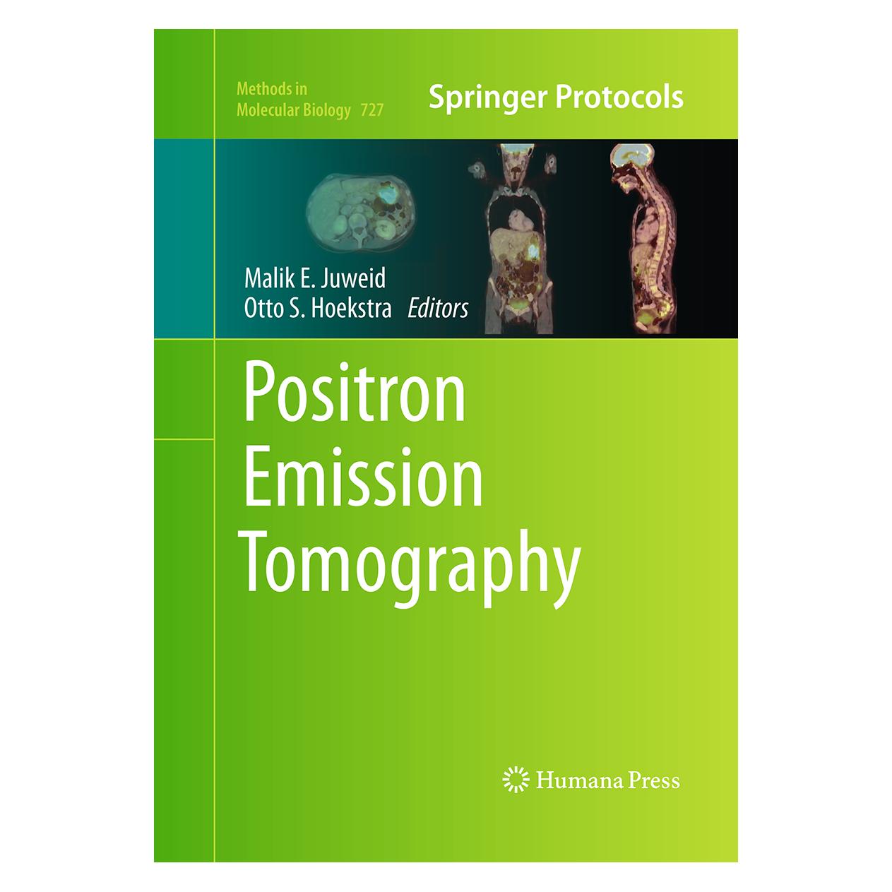Springer Positron Emission Tomography (Englisch, Softcover, Malik E. Juweid, Otto S. Hoekstra) (55965078)
