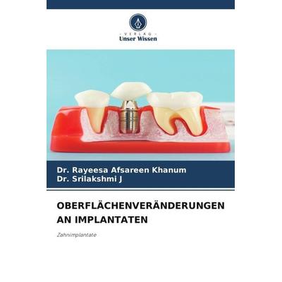 OBERFLÄCHENVERÄNDERUNGEN AN IMPLANTATEN, Taschenbuch von Rayeesa Afsareen Khanum,Srilakshmi J., Verlag Unser Wissen, 978-620-6-35579-3