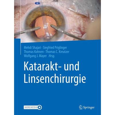 Katarakt- und Linsenchirurgie, Gebundene Ausgabe von , Springer Berlin, 978-3-662-62457-9