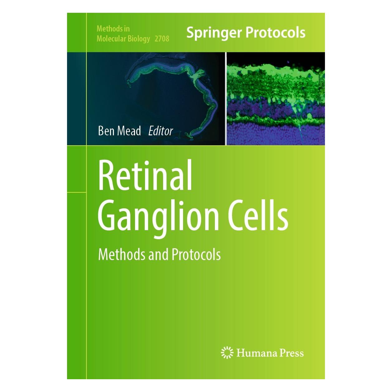 Springer Retinal Ganglion Cells (Englisch, Hardcover, Ben Mead) (9781071634080)