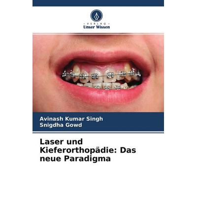 Laser und Kieferorthopädie: Das neue Paradigma, Taschenbuch von Avinash Kumar Singh,Snigdha Gowd, Verlag Unser Wissen, 978-620-4-51095-8
