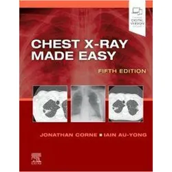 Chest X-Ray Made Easy, Fachbücher von Jonathan Corne, Iain Au-Yong