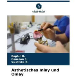 R.:Ãsthetisches Inlay und Onlay, Fachbücher von Swathika B, Raghul R, Ganesan S