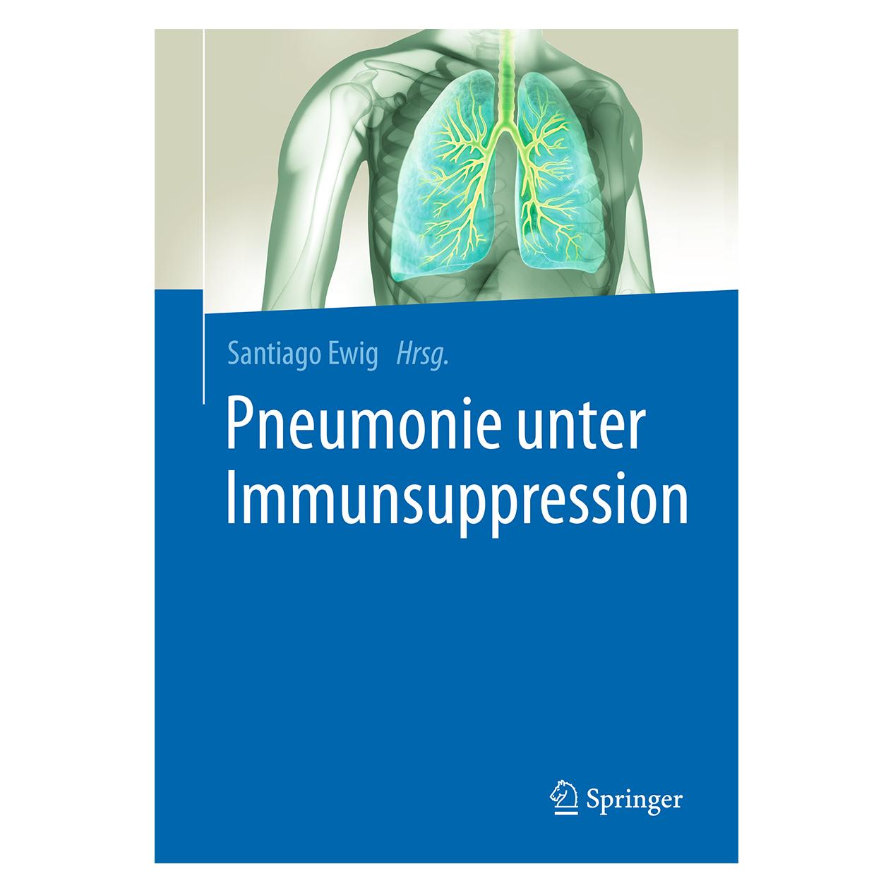 Springer Pneumonie unter Immunsuppression (Deutsch, Hardcover, Santiago Ewig) (9783662557402)