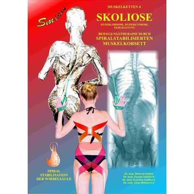 Skoliose, Taschenbuch von Richard Smíšek,Zuzana Smíšková,Kateřina Smíšková,Alena Böhmerová, Smisek, Richard, Dr. med., 978-80-88267-16-4