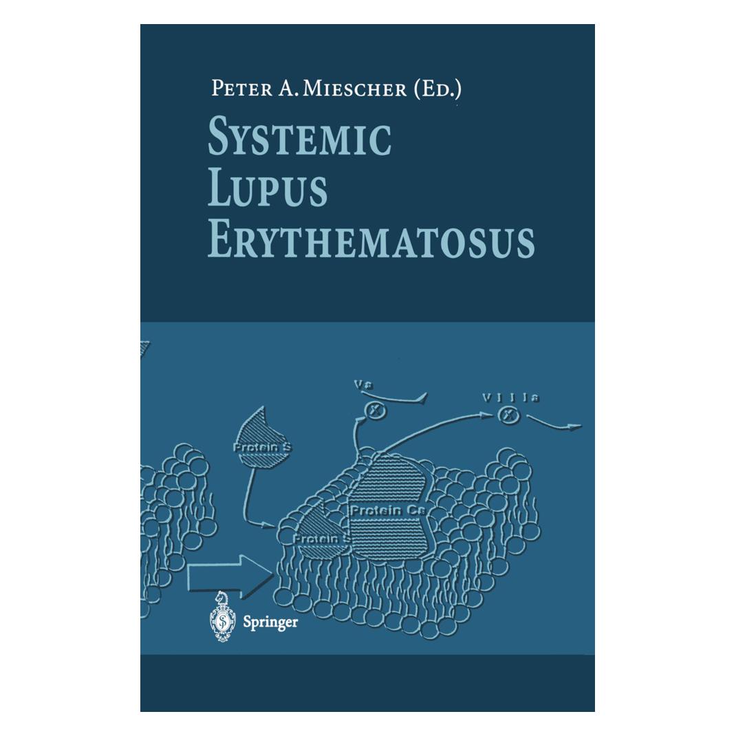 Springer Systemic Lupus Erythematosus (Englisch, Softcover) (55507745)