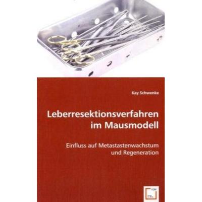 Schwenke, K: Leberresektionsverfahren im Mausmodell, Taschenbuch von Kay Schwenke, VDM, 978-3-639-03685-5