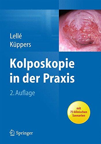 Lellé, Ralph J. - Kolposkopie in der Praxis - Preis vom 18.10.2026 19:22:15 h