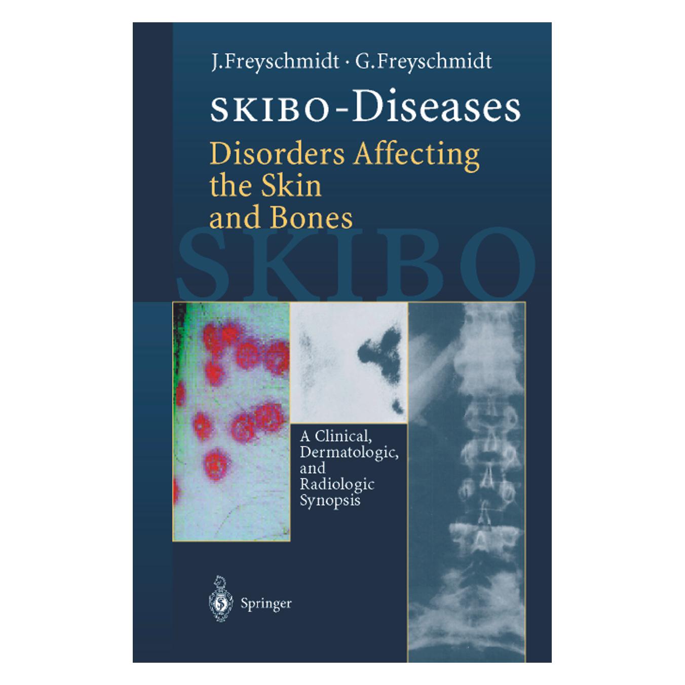 Springer SKIBO-Diseases Disorders Affecting the Skin and Bones (Englisch, Softcover, Gisela Freyschmidt, Jürgen Freyschmidt) (55530039)
