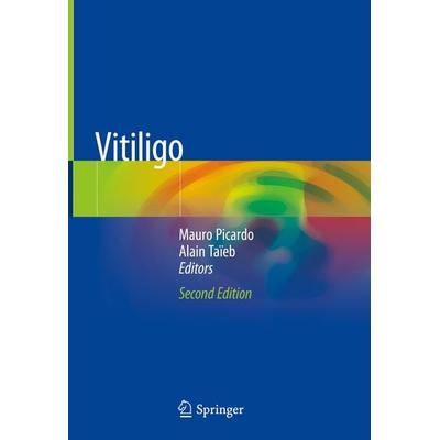 Vitiligo, Gebundene Ausgabe von , Springer, 978-3-319-62958-2