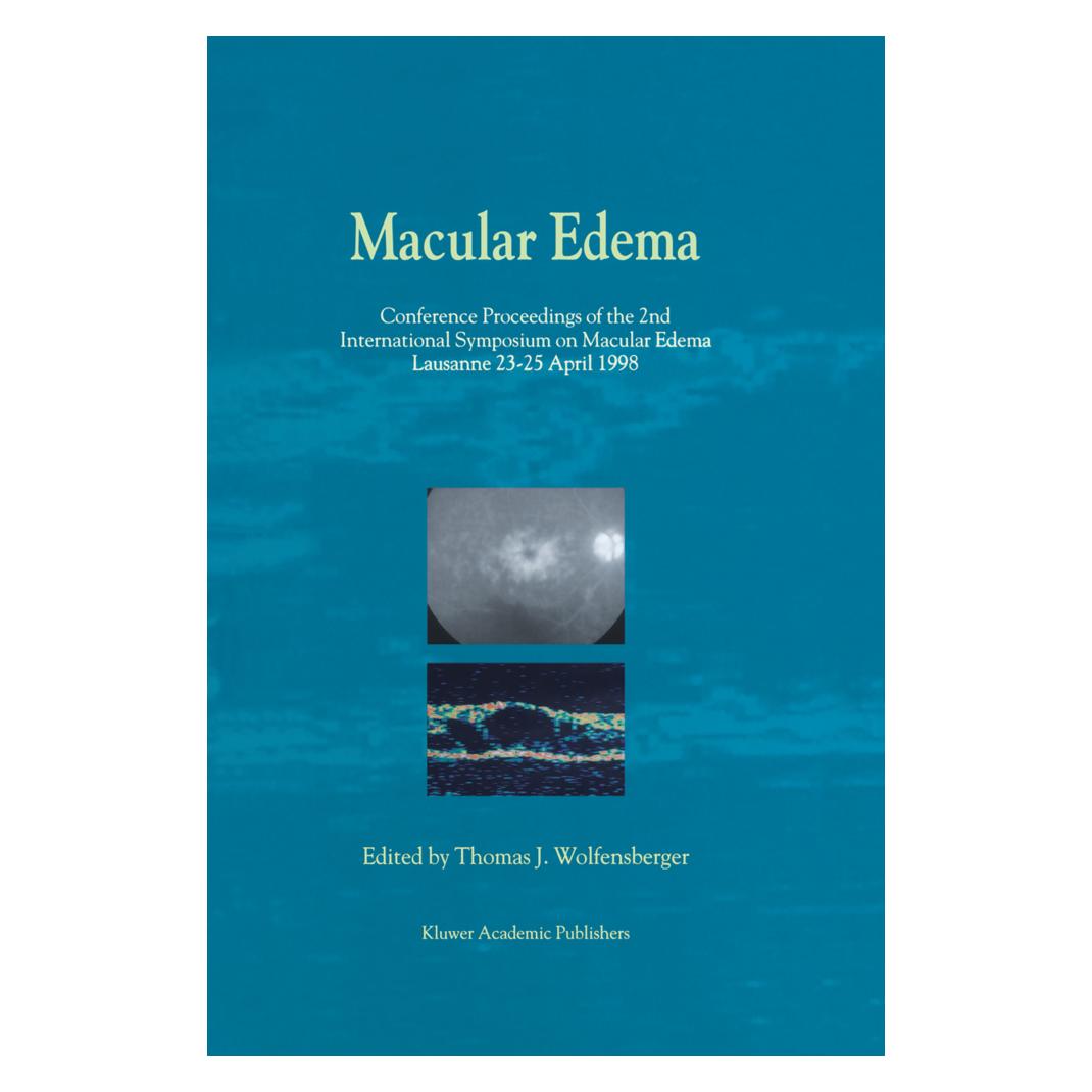 Springer Macular Edema (Englisch, Softcover, Thomas J. Wolfensberger) (55530131)