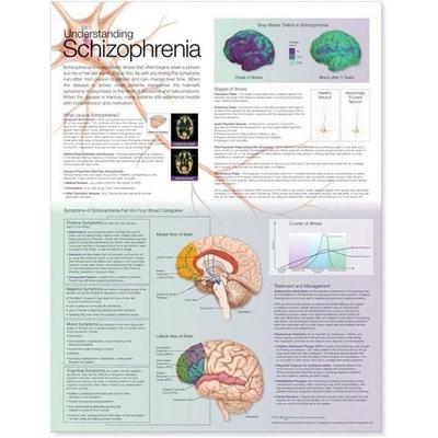 Understanding Schizophrenia Anatomical Chart, Nonbook von , Wolters Kluwer Health, 978-0-7817-8644-7
