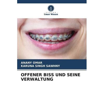OFFENER BISS UND SEINE VERWALTUNG, Taschenbuch von Anany Omar,Karuna Singh Sawhny, Verlag Unser Wissen, 978-620-6-39936-0