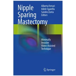 Nipple Sparing Mastectomy, Fachbücher von Sandro Zonta, Alberta Ferrari, Adele Sgarella