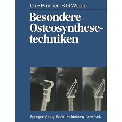 Besondere Osteosynthesetechniken, Taschenbuch von C. F. Brunner,B. G. Weber, Springer Berlin, 978-3-642-93181-9