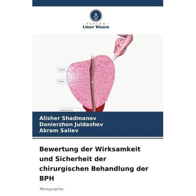 Bewertung der Wirksamkeit und Sicherheit der chirurgischen Behandlung der BPH, Taschenbuch von Alisher Shadmanov,Donierzhon Juldashev,Akram Saliev,