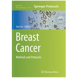 Breast Cancer, Fachbücher von Jian Cao