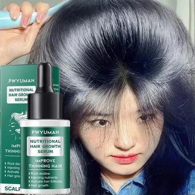 Uplift Essentials Ginger Hair Growth Serum 7 Day Fast Regrowth Anti Hair Loss Scalp Repair And Root Nourishing Care Ginger Hair Growth Serum 7 Day Fast Regrowth Anti Hair Loss Scalp Repair And Root Nourishing Care