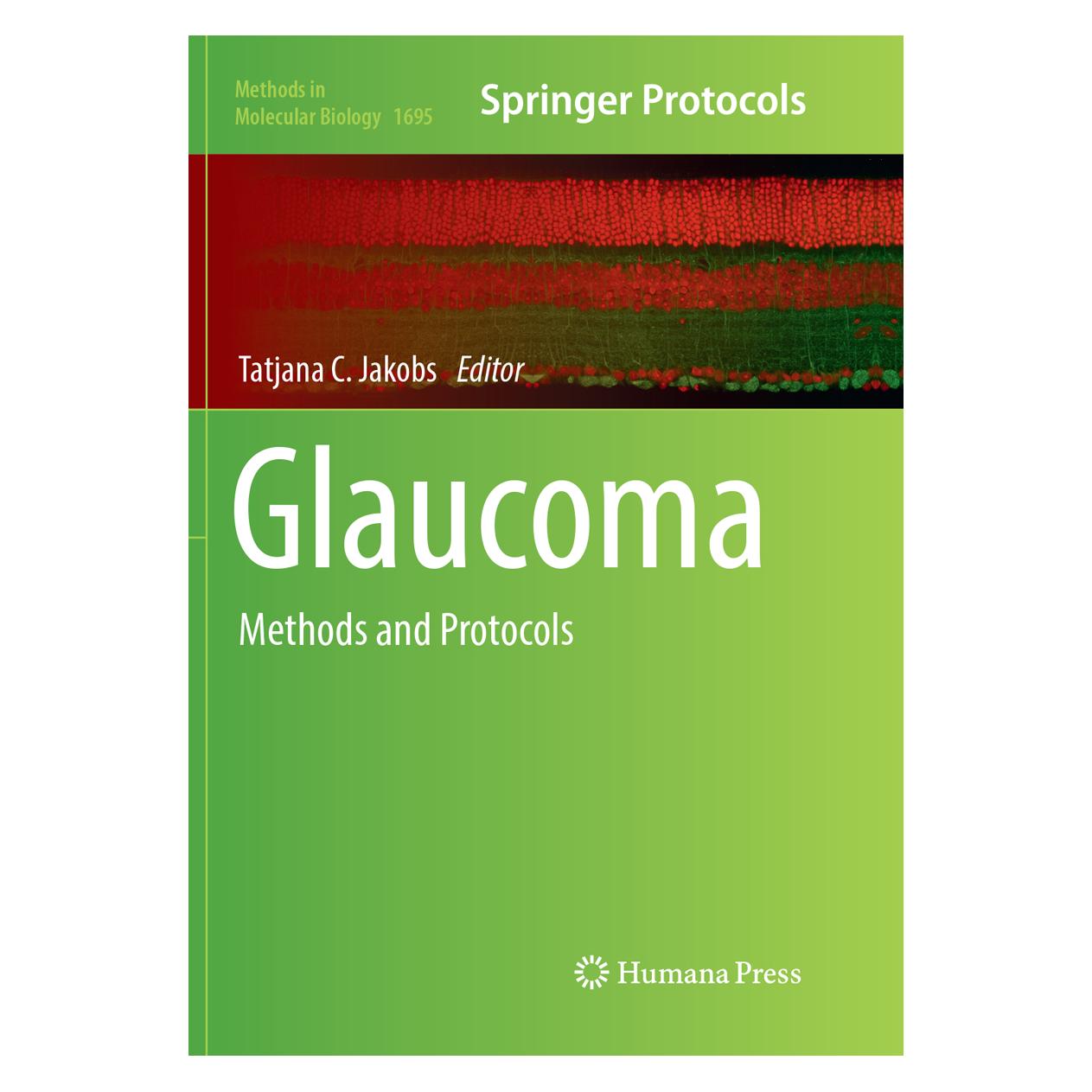 Springer Glaucoma (Englisch, Softcover, Tatjana C. Jakobs) (56053443)