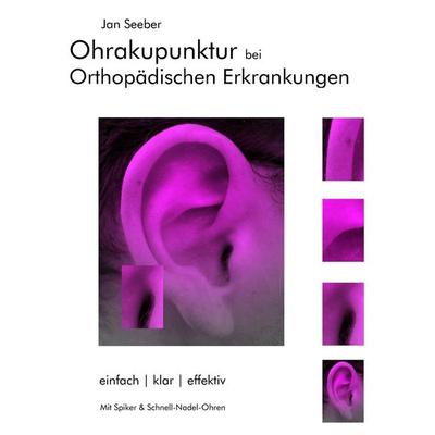 Ohrakupunktur bei Orthopädischen Erkrankungen, Taschenbuch von Jan Seeber, BoD – Books on Demand, 978-3-8370-2781-5