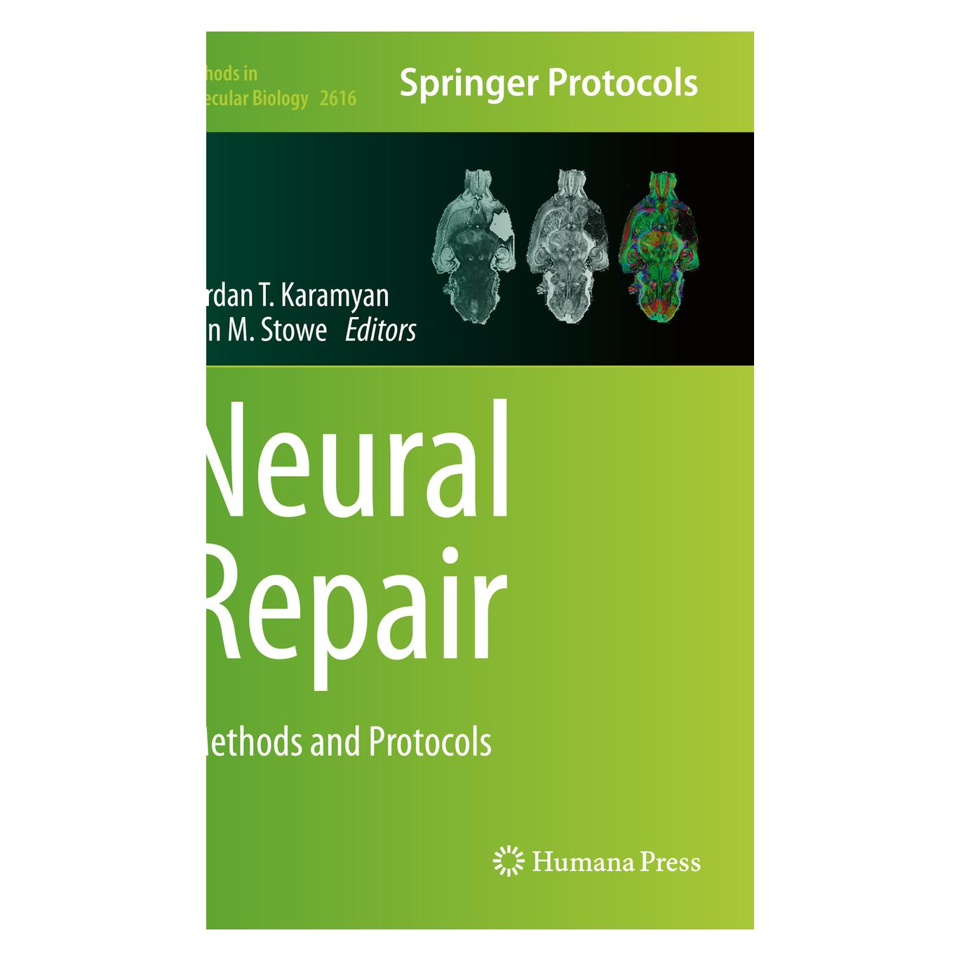 Springer Neural Repair (Englisch, Softcover, Ann M. Stowe, Vardan T. Karamyan) (56999600)