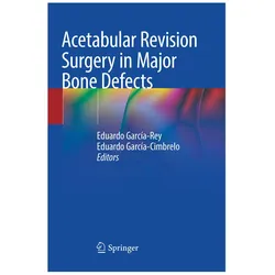 Acetabular Revision Surgery in Major Bone Defects, Fachbücher von Eduardo García-Cimbrelo, Eduardo García-Rey