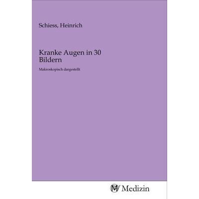 Kranke Augen in 30 Bildern, Taschenbuch von , MV-Medizin, 978-3-96875-235-8