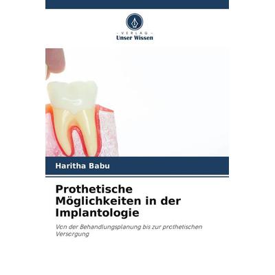 Prothetische Möglichkeiten in der Implantologie, Taschenbuch von Haritha Babu, Verlag Unser Wissen