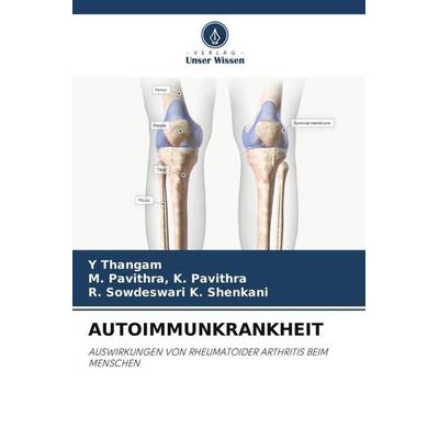 Autoimmunkrankheit, Taschenbuch von Y. Thangam,M. Pavithra K. Pavithra,R. Sowdeswari K. Shenkani, Verlag Unser Wissen, 978-620-5-89626-6