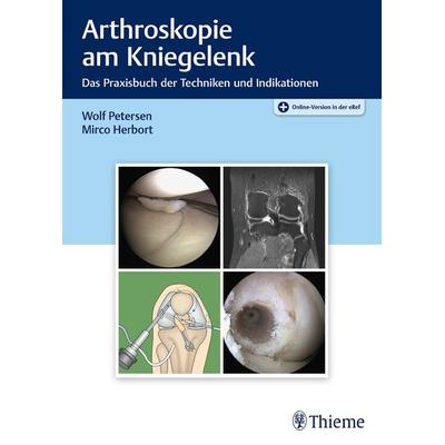 Arthroskopie am Kniegelenk, Set von Wolf Petersen,Mirco Herbort, Thieme, 978-3-13-242225-4