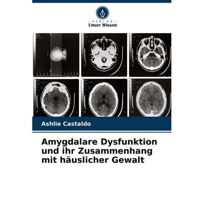 Amygdalare Dysfunktion und ihr Zusammenhang mit häuslicher Gewalt, Taschenbuch von Ashlie Castaldo, Verlag Unser Wissen, 978-620-7-31383-9