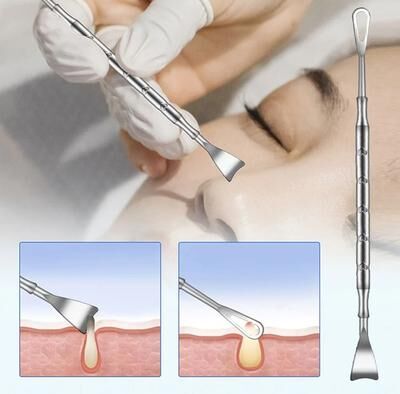 Uplifted Finds Double Ended Stainless Steel Blackhead And Acne Removal Needle For Facial Cleaning Double Ended Stainless Steel Blackhead And Acne Removal Needle For Facial Cleaning