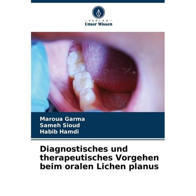 Diagnostisches und therapeutisches Vorgehen beim oralen Lichen planus, Taschenbuch von Maroua Garma,Sameh Sioud,Habib Hamdi, Verlag Unser Wissen,