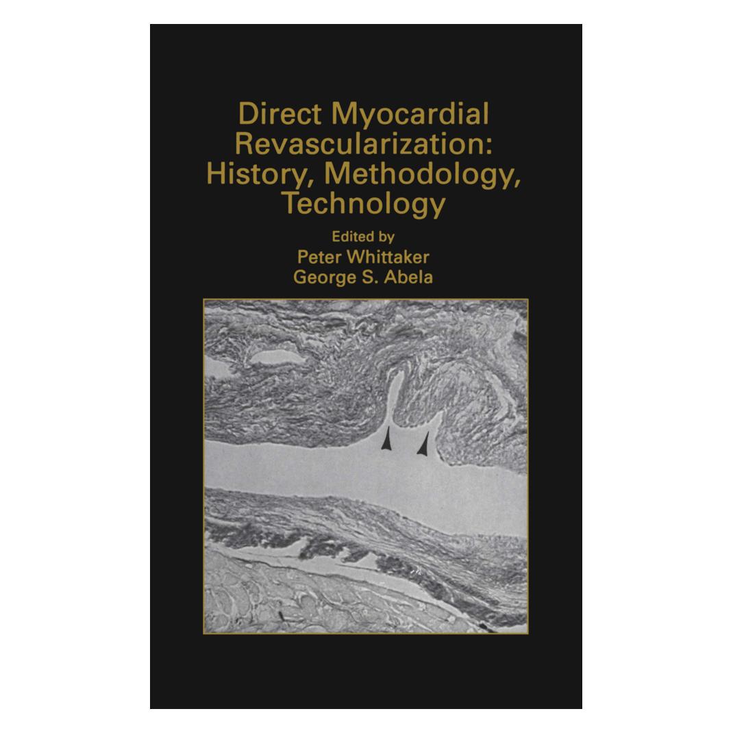 Springer Direct Myocardial Revascularization: History, Methodology, Technology (Englisch, Softcover, George S. Abela, Peter Whittaker) (55520668)