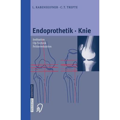 Endoprothetik Knie, Taschenbuch von L. Rabenseifner,C. Trepte, Steinkopff, 978-3-642-63313-3