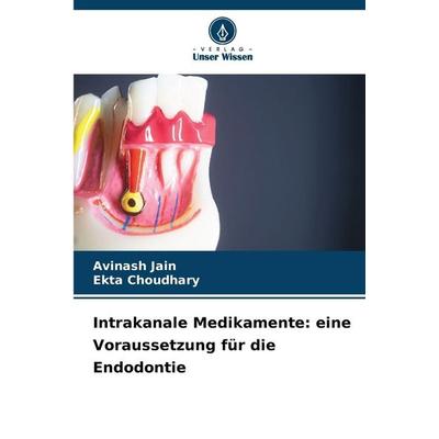 Intrakanale Medikamente: eine Voraussetzung für die Endodontie, Taschenbuch von Avinash Jain,Ekta Choudhary, Verlag Unser Wissen, 978-620-6-83739-8