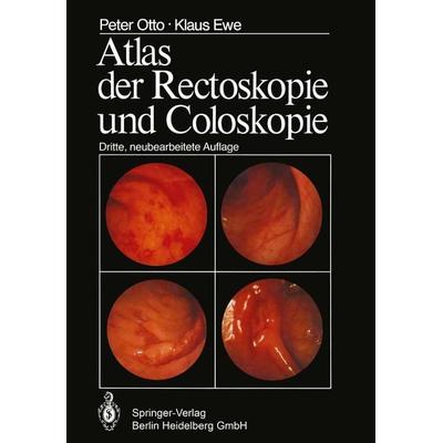 Atlas der Rectoskopie und Coloskopie, Taschenbuch von P. Otto,K. Ewe, Springer Berlin, 978-3-662-05880-0