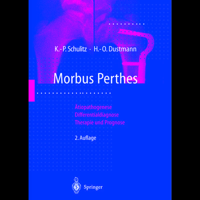 Morbus Perthes, Taschenbuch von Klaus-Peter Schulitz,Hans-Otto Dustmann, Springer Berlin, 978-3-642-63772-8