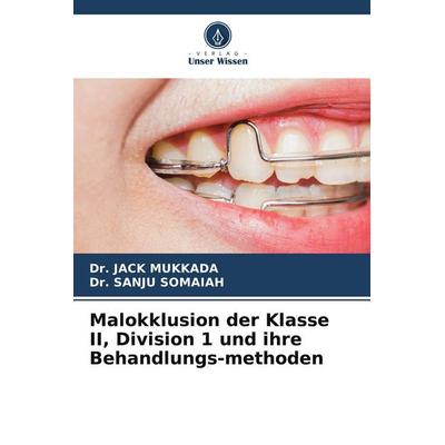 Malokklusion der Klasse II, Division 1 und ihre Behandlungs-methoden, Taschenbuch von Jack Mukkada,Sanju Somaiah, Verlag Unser Wissen