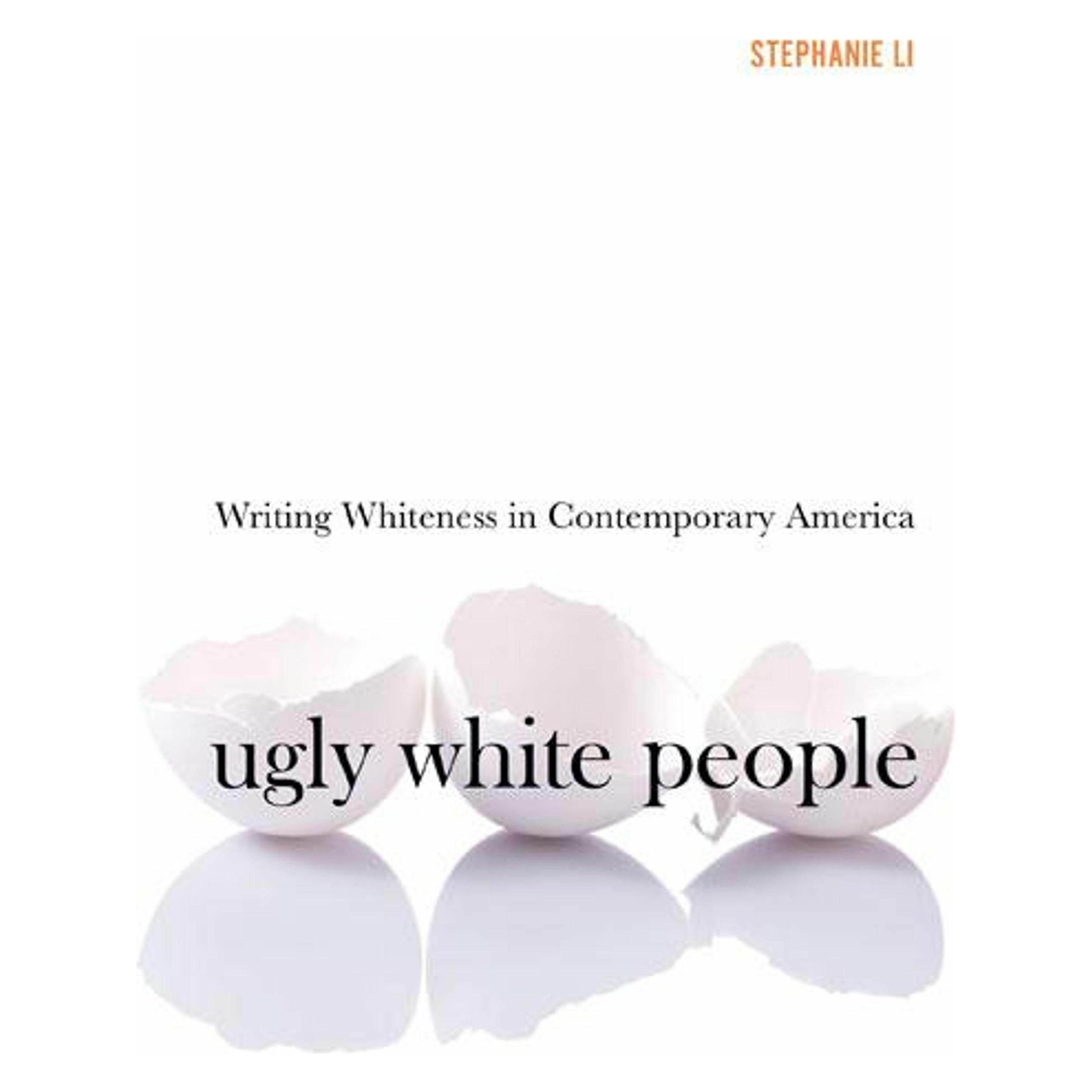 University Of Minnesota Ugly White People (47751622)