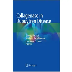 Collagenase in Dupuytren Disease, Fachbücher von Lawrence C. Hurst, Marie A. Badalamente, Giorgio Pajardi