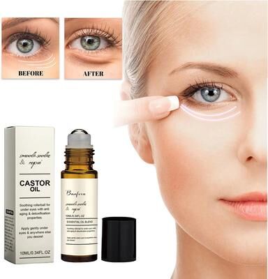 Uplift Essentials Castor Oil Eye Serum Anti Wrinkle Dark Circle And Puffiness Remover Castor Oil Eye Serum Anti Wrinkle Dark Circle And Puffiness Remover