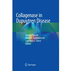 Collagenase in Dupuytren Disease, Fachbücher von Lawrence C. Hurst, Marie A. Badalamente, Giorgio Pajardi