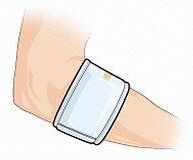 Dr. Gibaud Gibaud Ortho Bracc Tenn Elbow