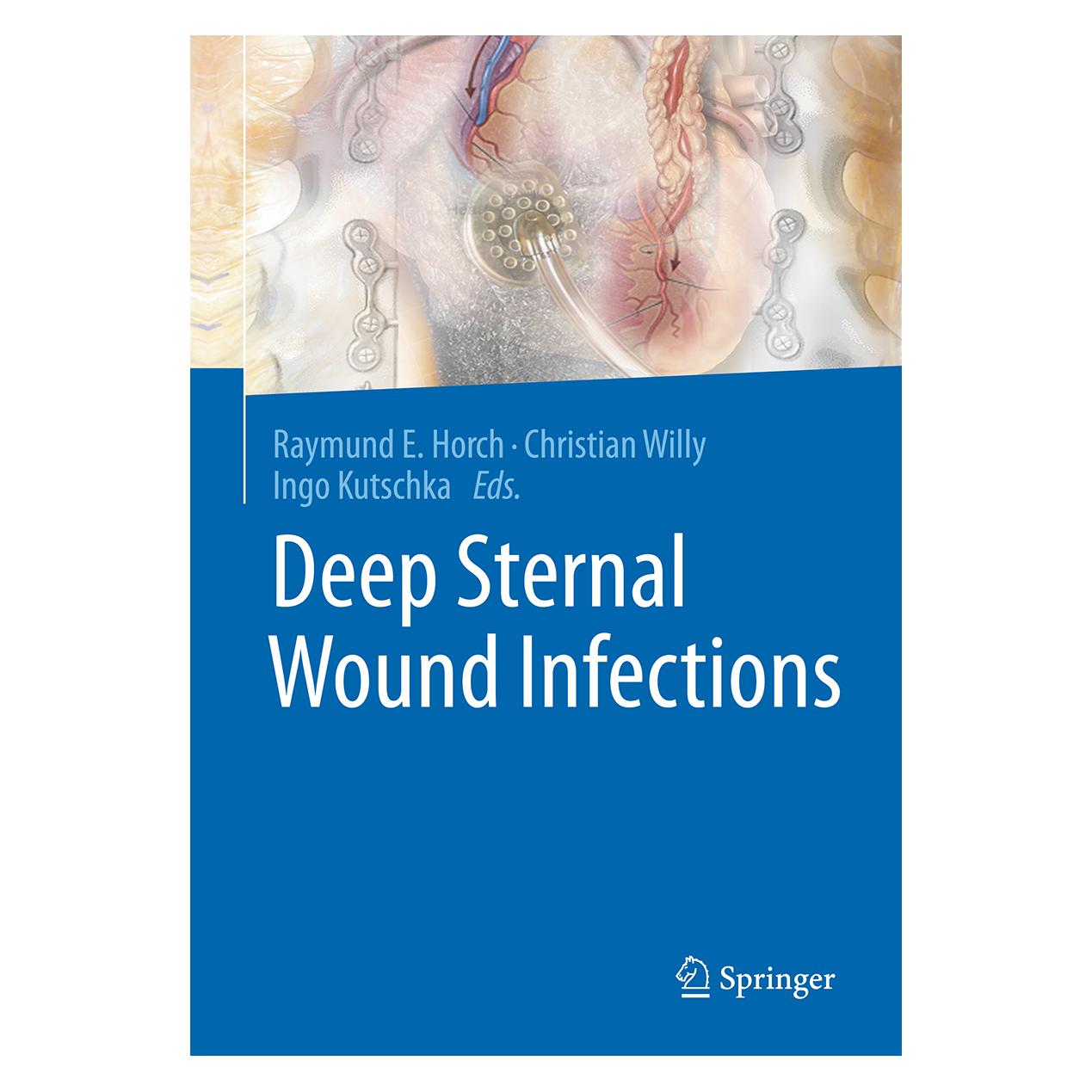 Springer Deep Sternal Wound Infections (Englisch, Hardcover, Christian Willy, Ingo Kutschka, Raymund E. Horch) (9783662497647)