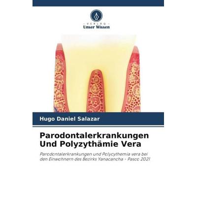 Parodontalerkrankungen Und Polyzythämie Vera, Taschenbuch von Hugo Daniel Salazar, Verlag Unser Wissen, 978-620-5-55669-6