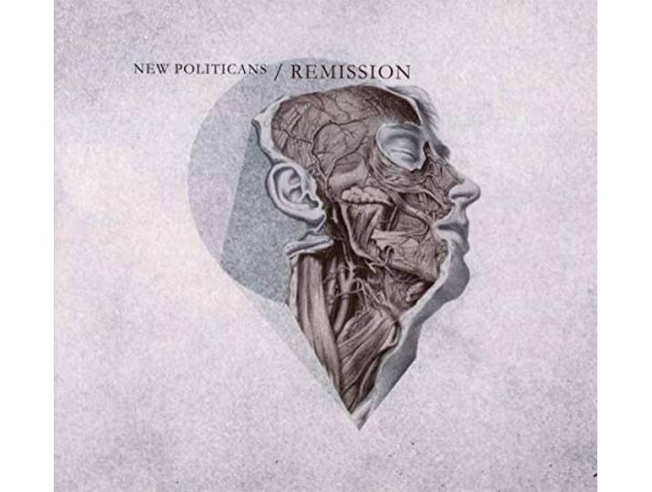 New Politicians - Remission