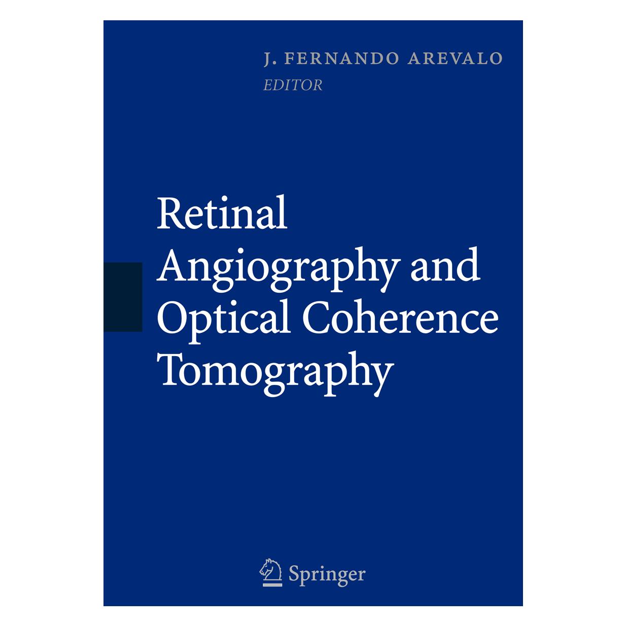 Springer Retinal Angiography and Optical Coheren (Englisch, Hardcover, J. Fernando Arevalo) (9780387689869)