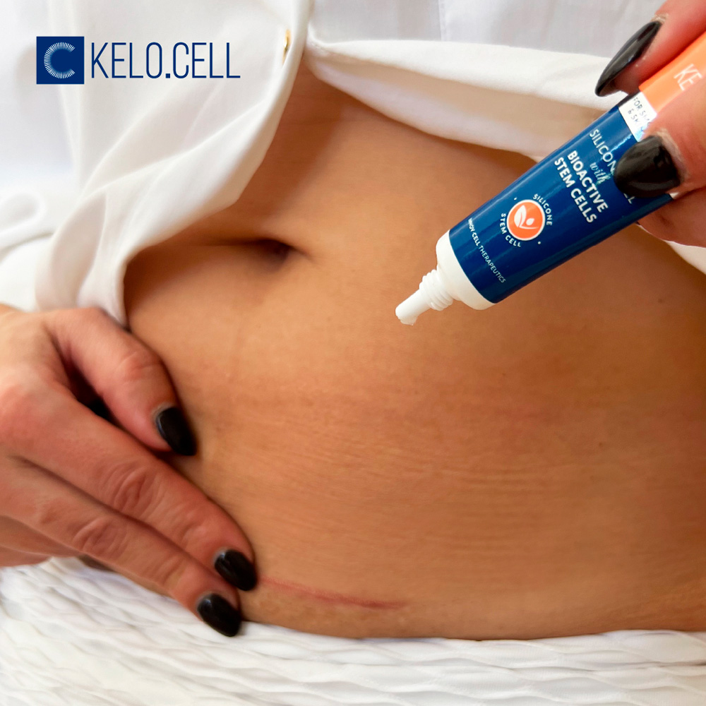 Kelo.Cell Gel Reductor de Cicatrices de Silicona 6g